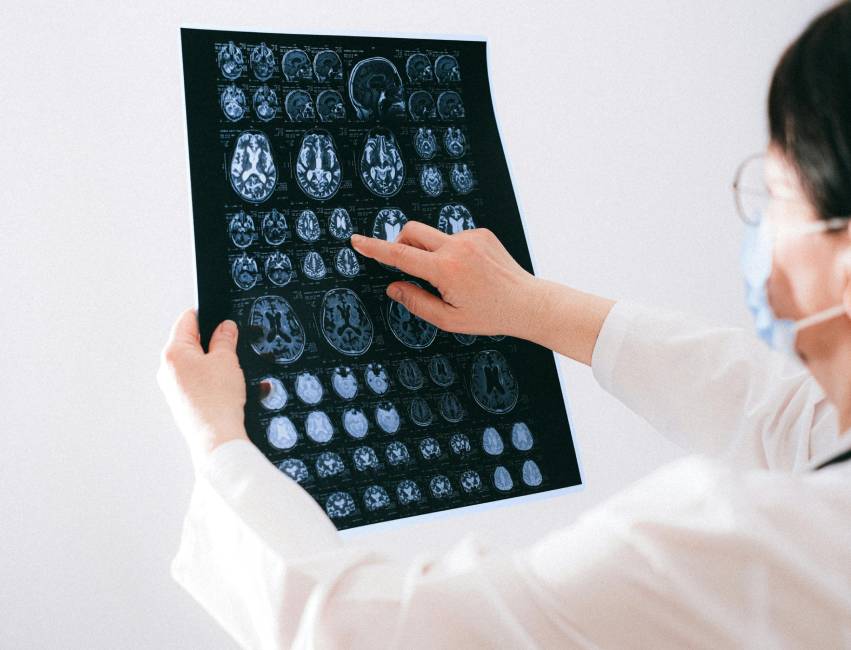 servicio neuro intervencionismo